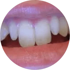 Length and width of tooth