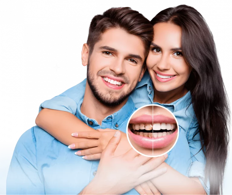 Before and after smile makeover transformation