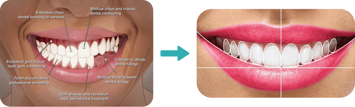 Smile makeover procedure explanation